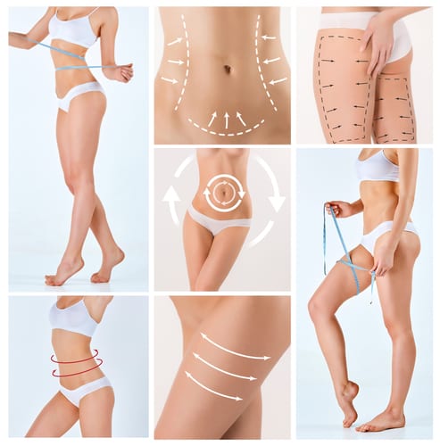 Body Plastic Surgery