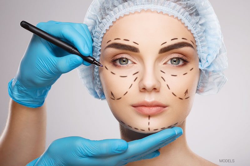 Beautiful woman with surgical lines drawn on face next to surgeon's hand.